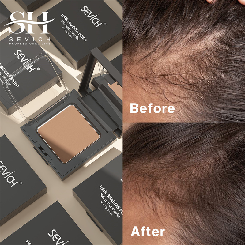 헤어 라인 섀도우 파우더 블랙 루트 커버 업 채우기 이 - Rooting Hormone Powder 리뷰 및 가격